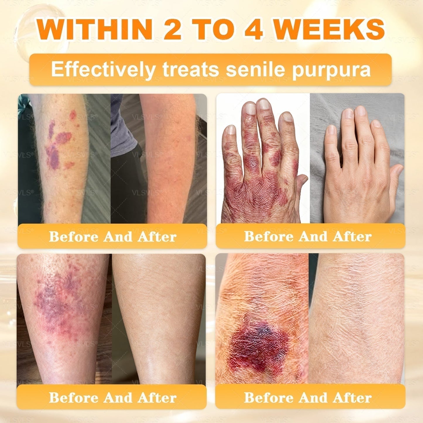 🔥 DERNIER JOUR – 80 % DE RÉDUCTION 🔥Crème Réparatrice pour la Peau au Venin d’Abeille Aeehfeng®
