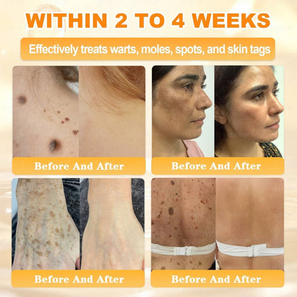 🔥 DERNIER JOUR – 80 % DE RÉDUCTION 🔥Crème Réparatrice pour la Peau au Venin d’Abeille Aeehfeng®