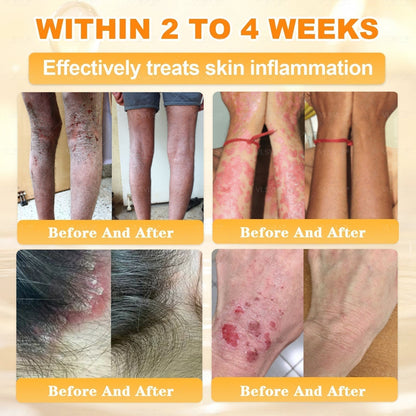 🔥 DERNIER JOUR – 80 % DE RÉDUCTION 🔥Crème Réparatrice pour la Peau au Venin d’Abeille Aeehfeng®